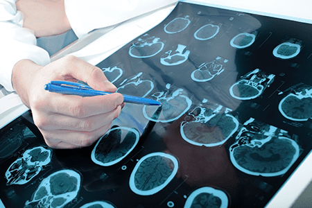 Diaz Ortuño, Antonio - Neurólogo Doctor analizando escáner cerebral